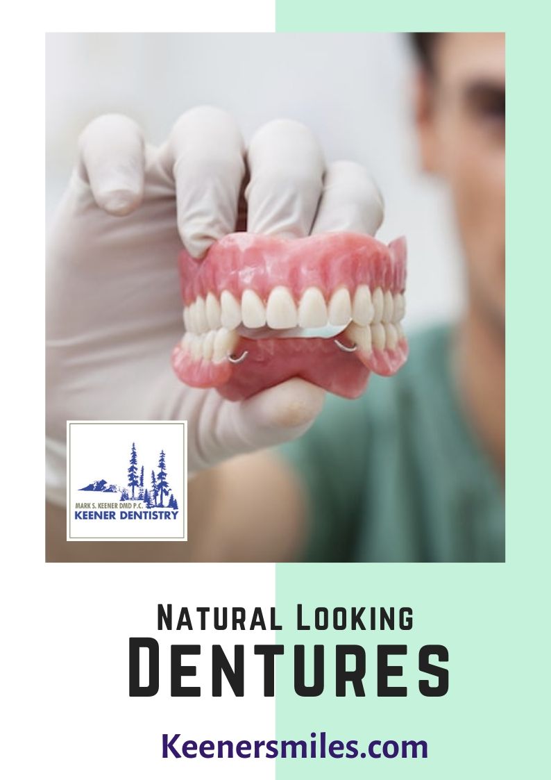 Natural-Looking-Dentures